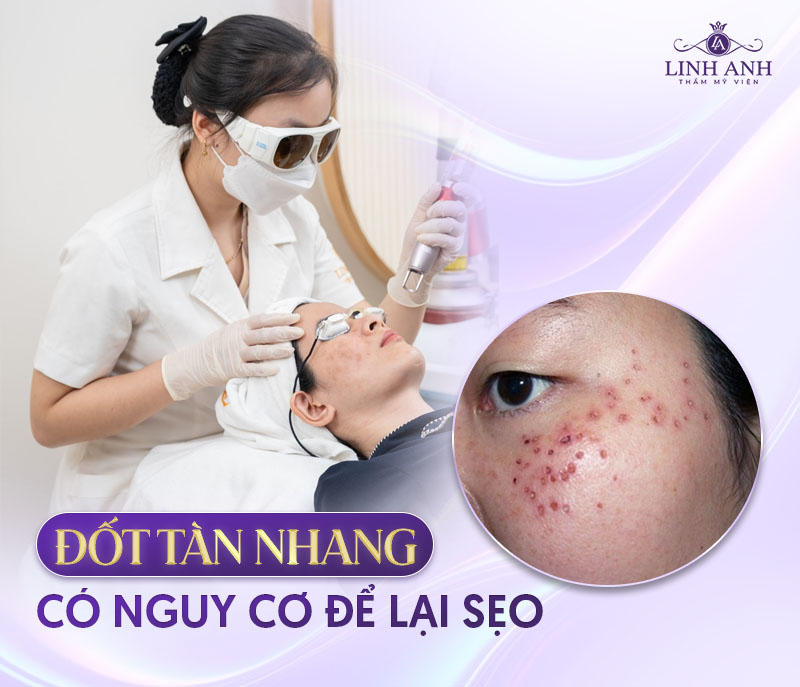 nguy cơ để lại sẹo khi đốt tàn nhang