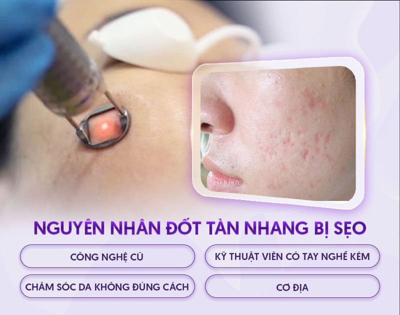 nguyên nhân để lại sẹo