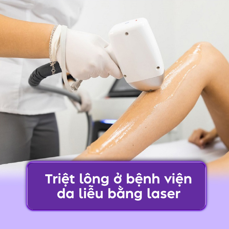 giá triệt lông ở bệnh viện da liễu giá triệt lông ở bệnh viện da liễu