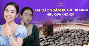 hạt gấc ngâm rượu trị nám