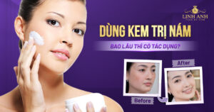 dùng kem trị nám bao lâu phát huy tác dụng