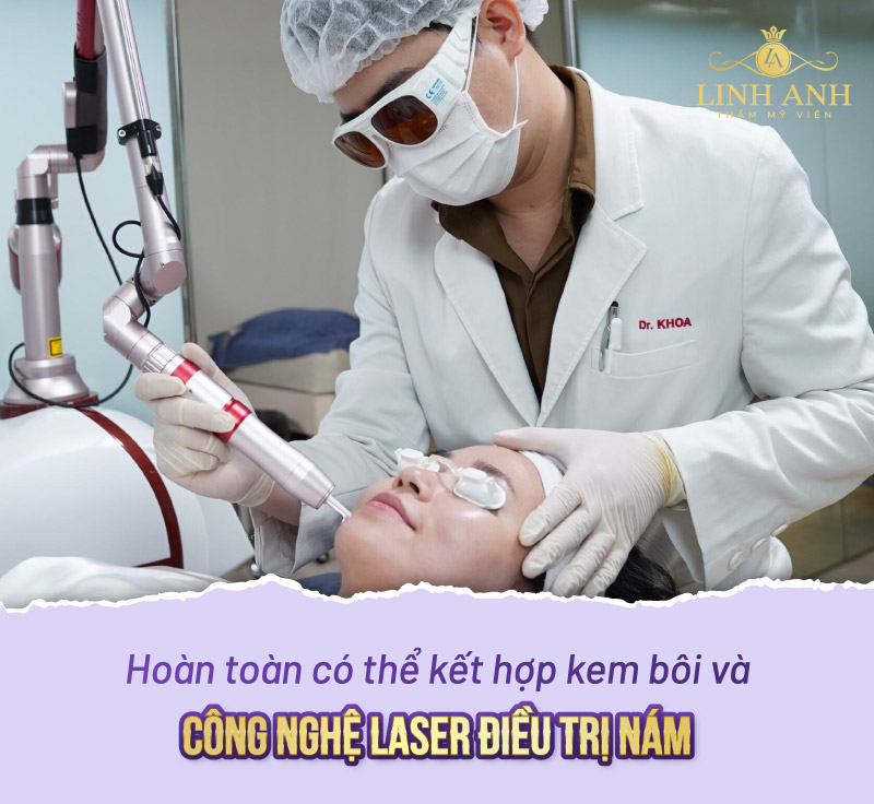 kết hợp kem bôi cùng công nghệ laser trị nám
