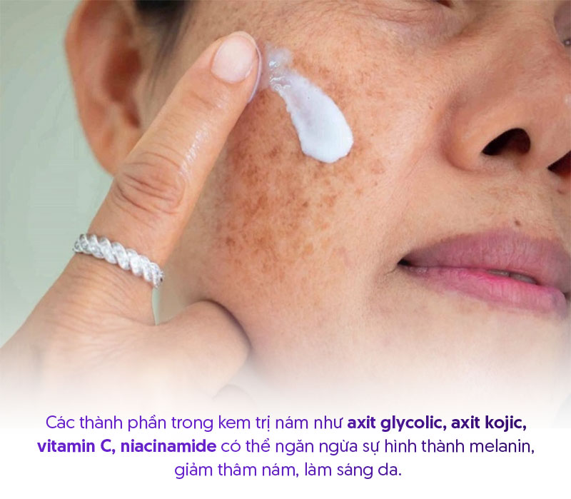 Có nên dùng kem trị nám cho tuổi 40