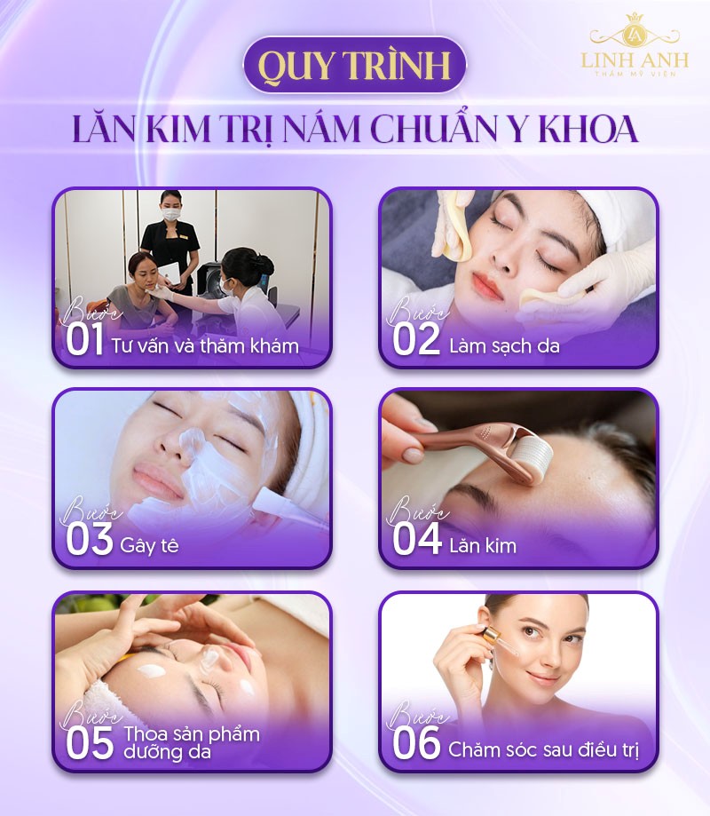 quy trình lăn kim trị nám