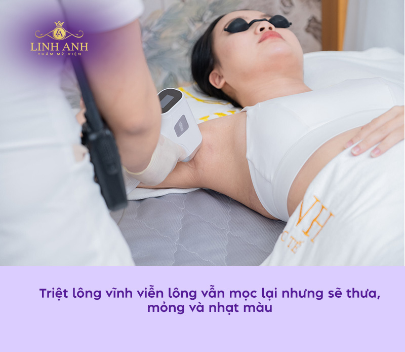laser diode trong triet long có đau không laser diode trong triet long có đau không