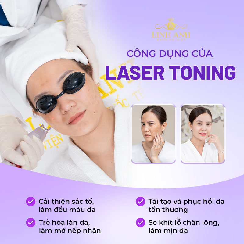 công dụng của laser toning