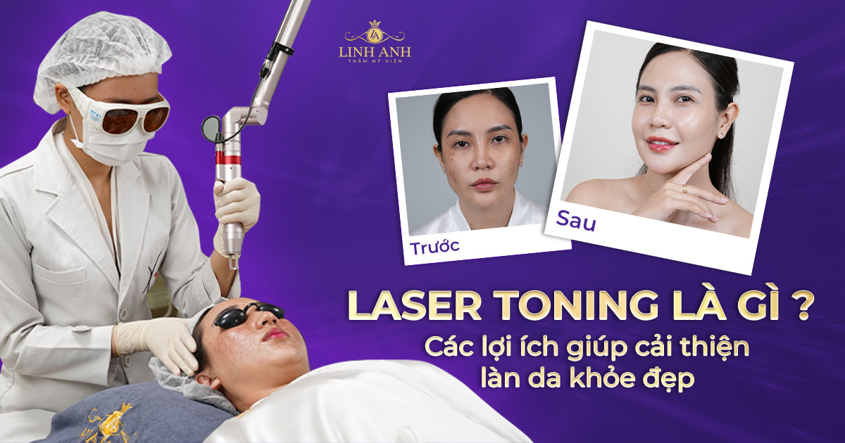 Laser Toning là gì? Các lợi ích giúp cải thiện làn da khỏe đẹp