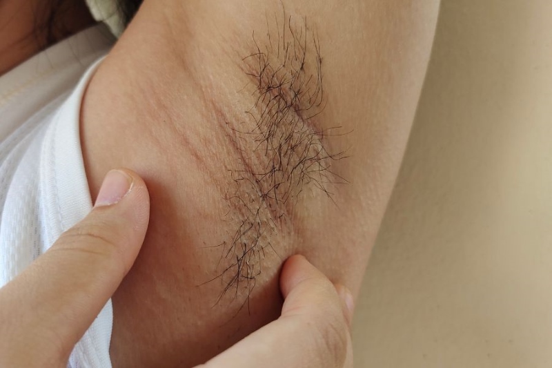 lông nách để làm gì lông nách để làm gì