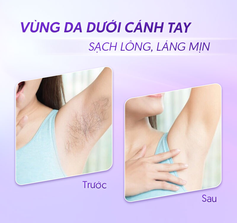 lông nách tuổi dậy thì phải làm sao lông nách tuổi dậy thì phải làm sao