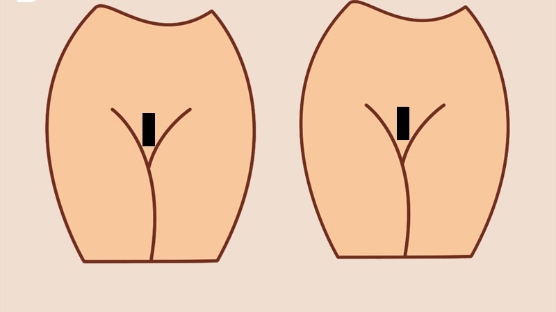 lông vùng kín kiểu brazilian strip lông vùng kín kiểu brazilian strip