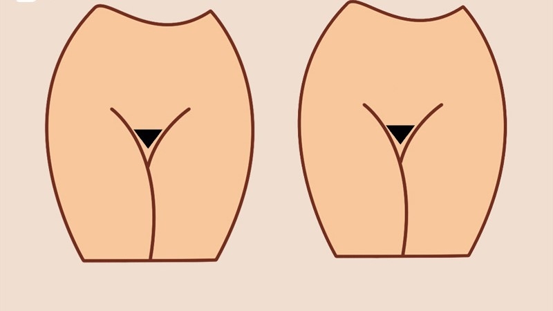 lông vùng kín kiểu tam giác nhỏ lông vùng kín kiểu tam giác nhỏ