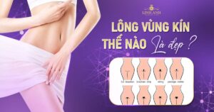 lông vùng kín thế nào là đẹp