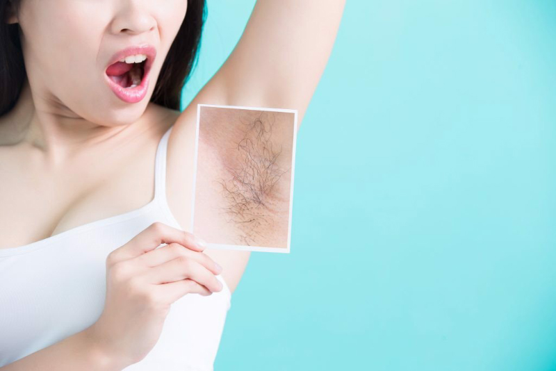mẹ bầu nhổ lông nách được không