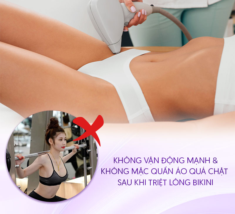 những lưu ý khi triệt lông bikini những lưu ý khi triệt lông bikini