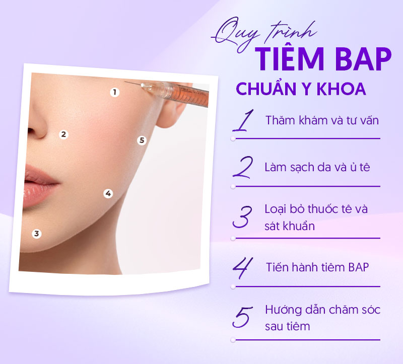 Quy trình tiêm BAP chuẩn y khoa