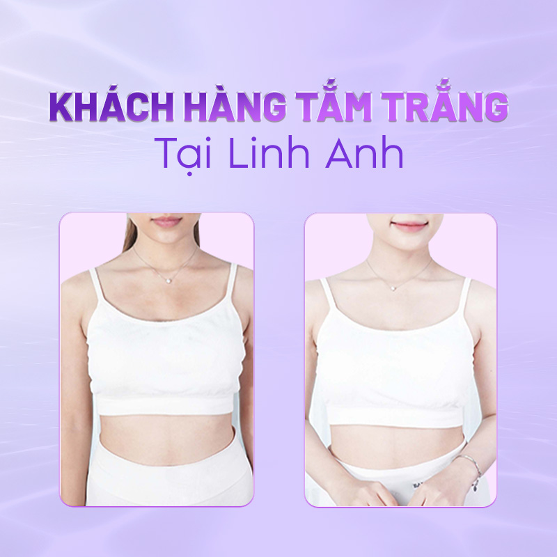 Review tắm trắng phi thuyền