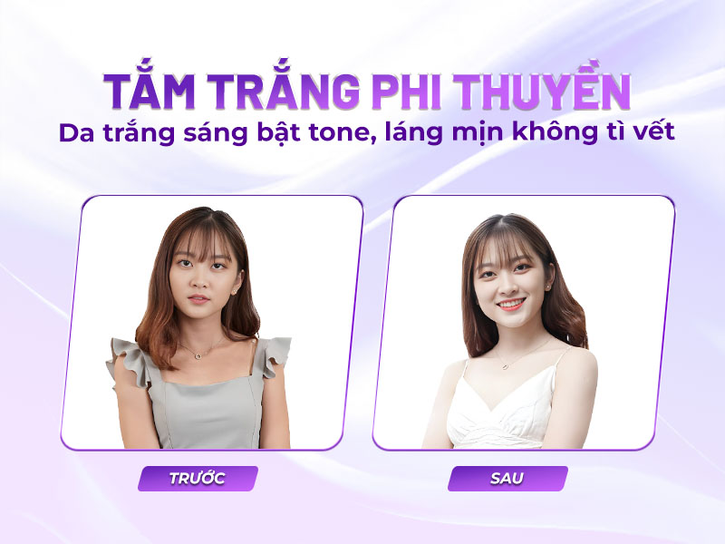 Sau tắm trắng phi thuyền có bị đen lại không