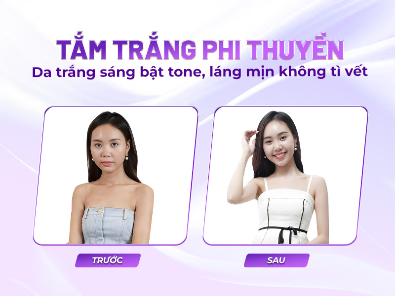 Sau tắm trắng phi thuyền có đen lại không