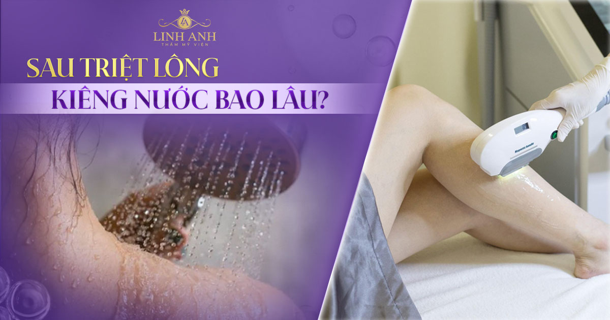 Sau triệt lông kiêng nước bao lâu