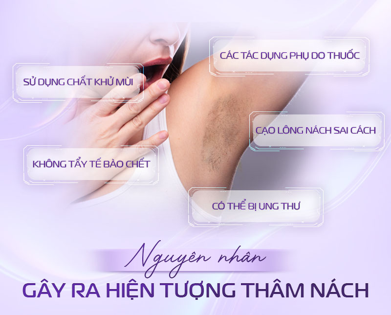 sau triệt lông nách có hết thâm không sau triệt lông nách có hết thâm không