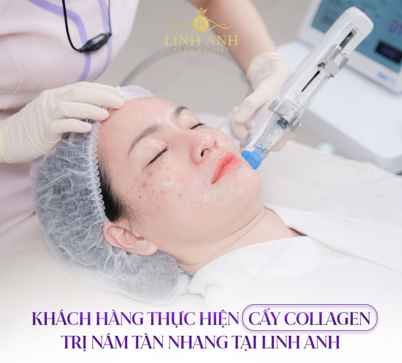 sử dụng serum kết hợp cấy collagen