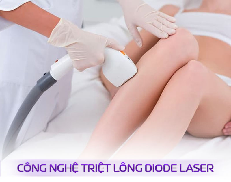 so sánh các công nghệ triệt lông so sánh các công nghệ triệt lông