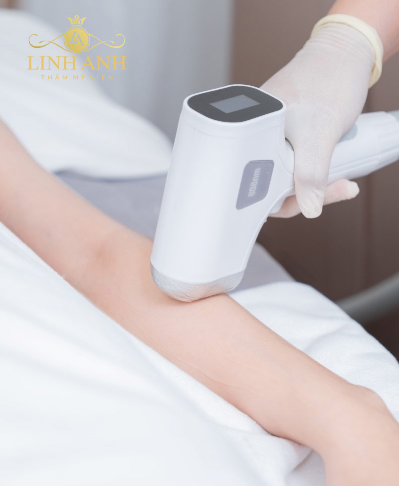 tại sao con gái nhiều lông tay tại sao con gái nhiều lông tay