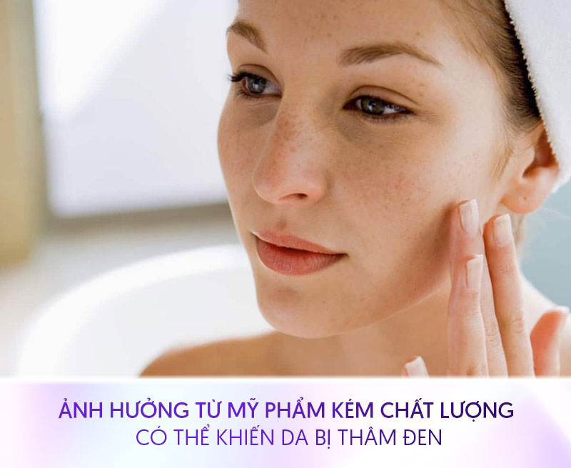 Tại sao ở nhà mà vẫn đen Tại sao ở nhà mà vẫn đen