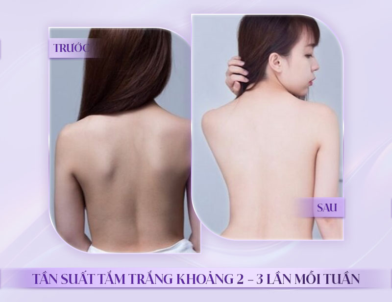 Tắm trắng bao lâu thì hiệu quả