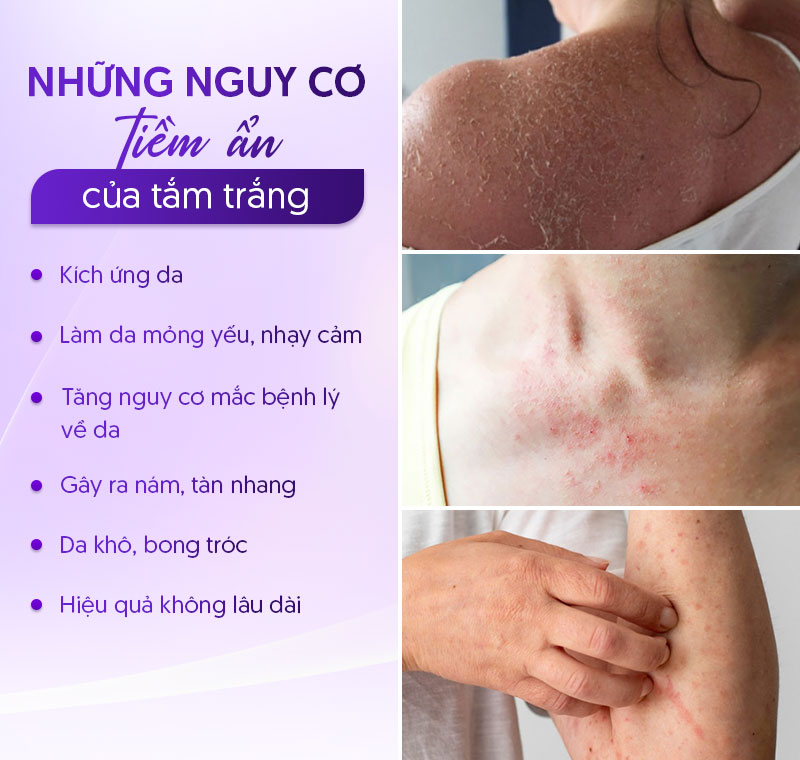 Tắm trắng có an toàn không