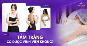 Tắm trắng có được vĩnh viễn không