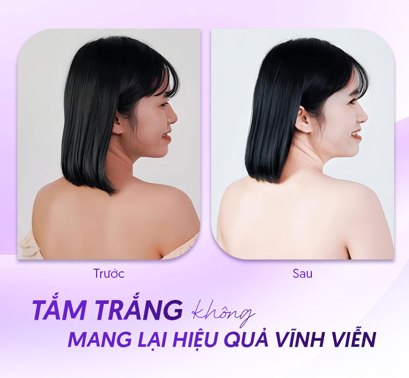 Tắm trắng có trắng vĩnh viễn không