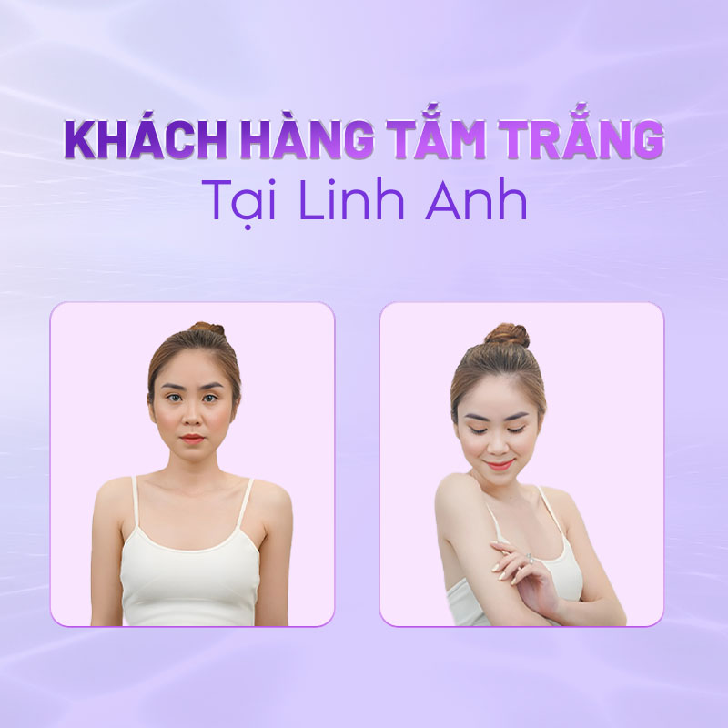 Tắm trắng phi thuyền giá bao nhiêu