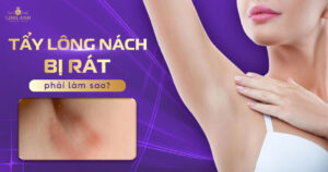 tẩy lông nách bị rát phải làm sao