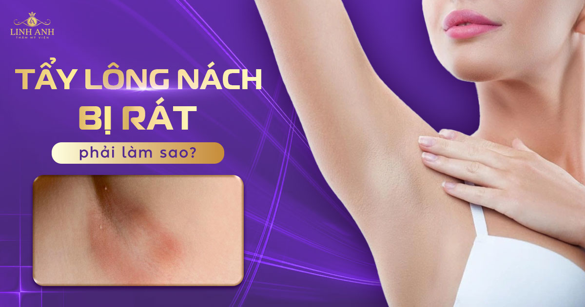 tẩy lông nách bị rát phải làm sao
