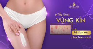 tẩy lông vùng kín bị đau rát phải làm sao
