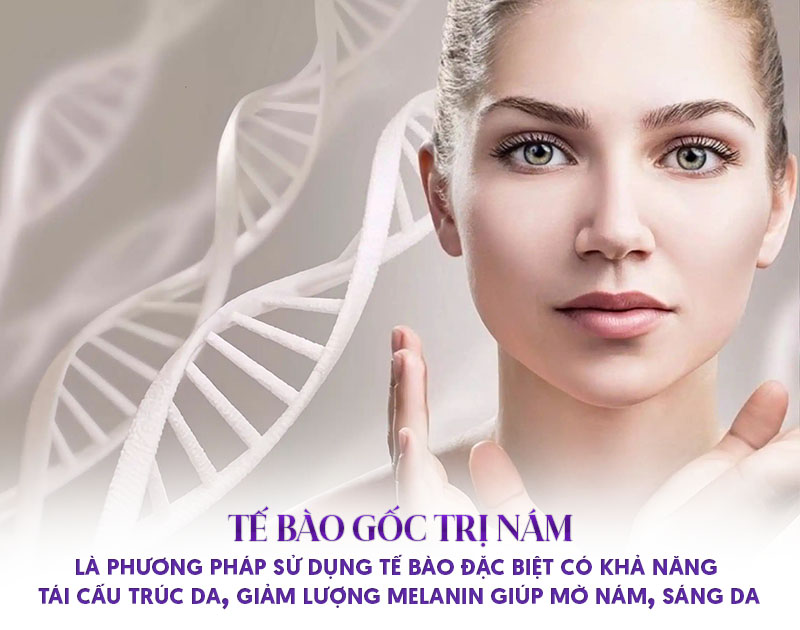 trị nám bằng tế bào gốc