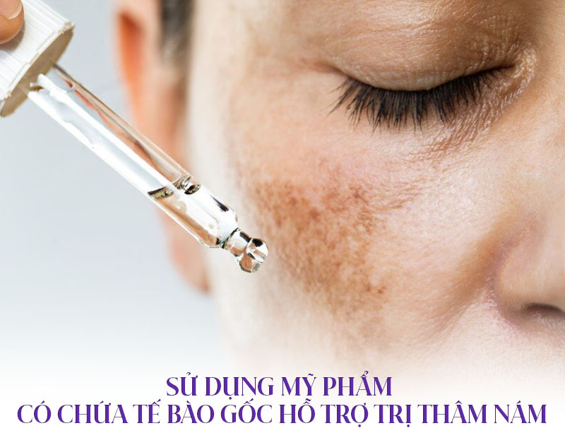 dùng mỹ phẩm chứa tế bào gốc trị nám