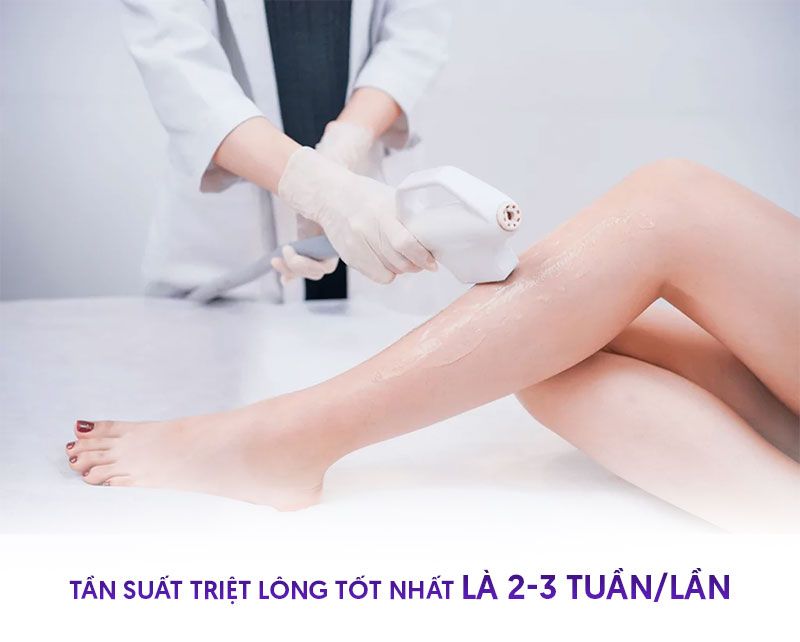 Thời gian triệt lông cách nhau bao lâu là hợp lý Thời gian triệt lông cách nhau bao lâu là hợp lý