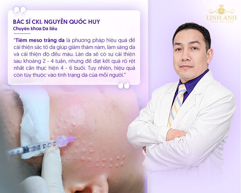 Tiêm meso trắng da có tốt không Tiêm meso trắng da có tốt không