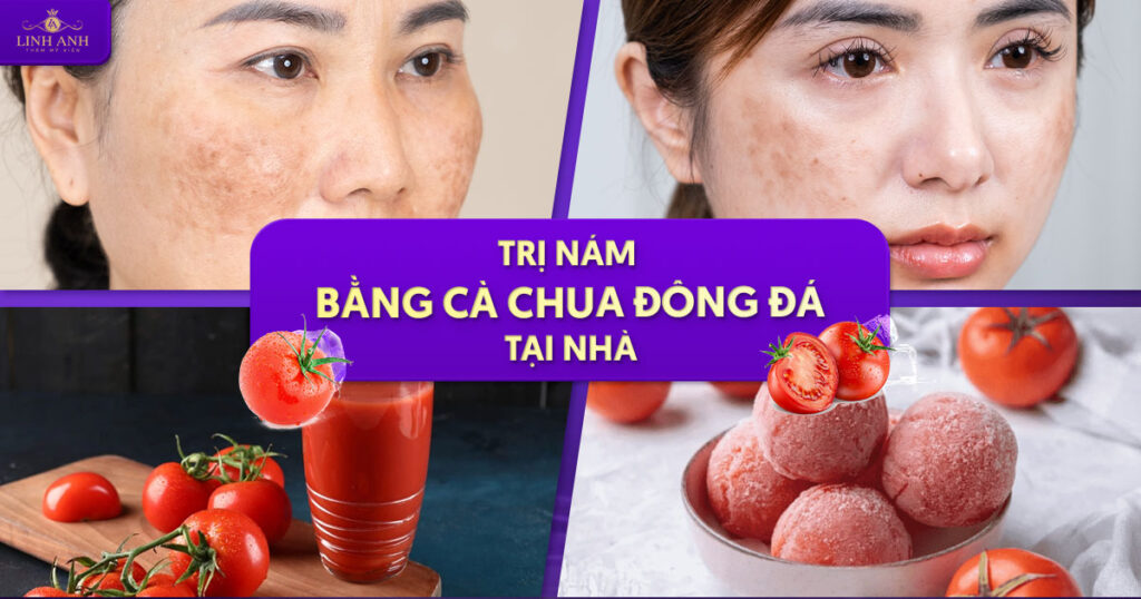 Trị nám bằng cà chua đông đá