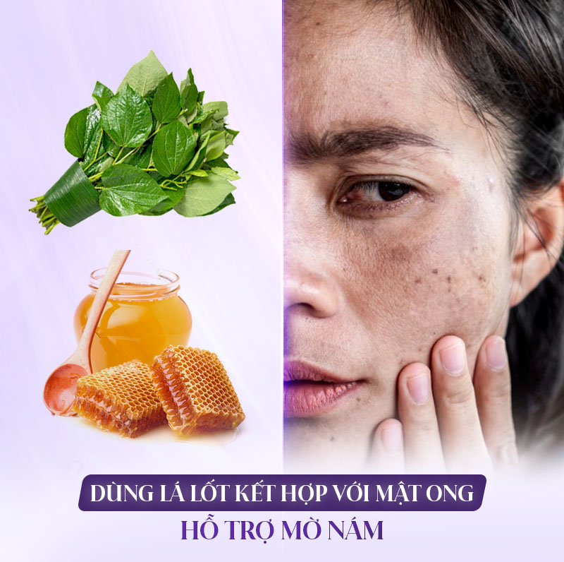 lá lốt kết hợp mật ong giảm nám