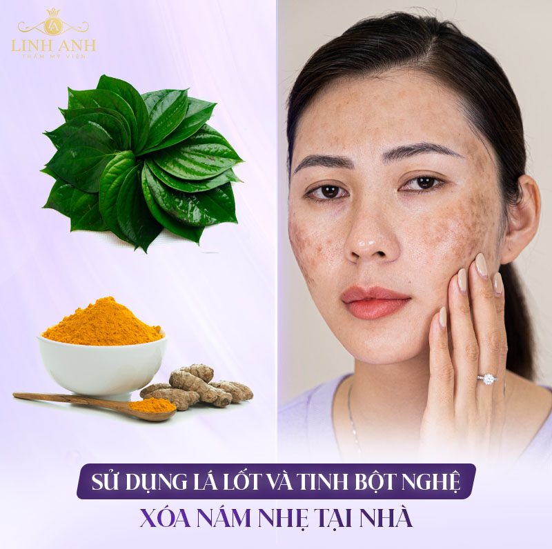 lá lốt kết hợp bột nghệ