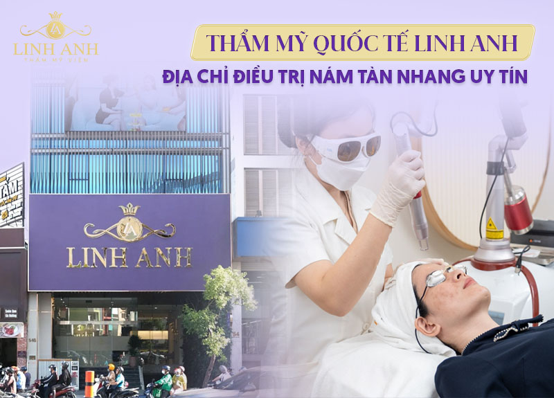 điều trị nám chuyên sâu