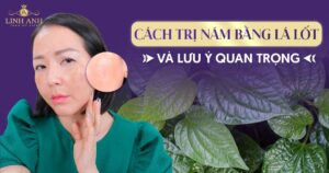 trị nám bằng lá lốt