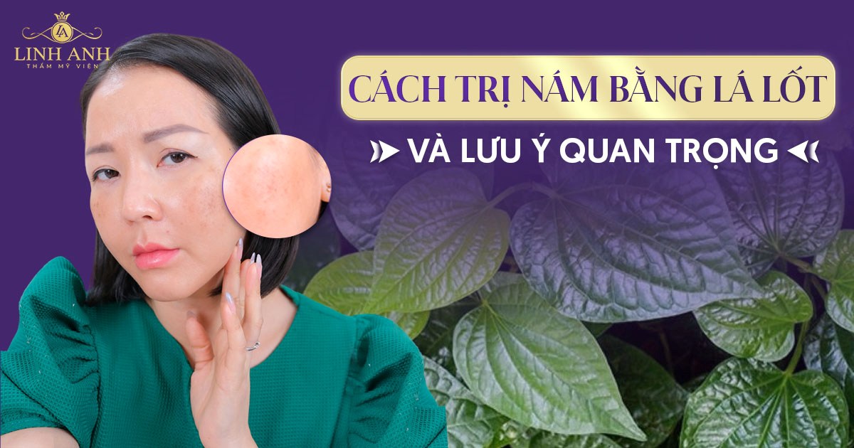 8 cách trị nám bằng lá lốt hiệu quả và những tác hại cần lưu ý