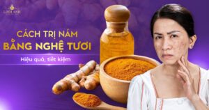 cách trị nám bằng nghệ tươi