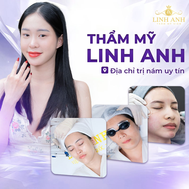 công nghệ hiện đại giúp mờ nám sáng da