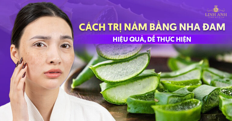 Bật mí 8 cách trị nám bằng nha đam hiệu quả, dễ thực hiện