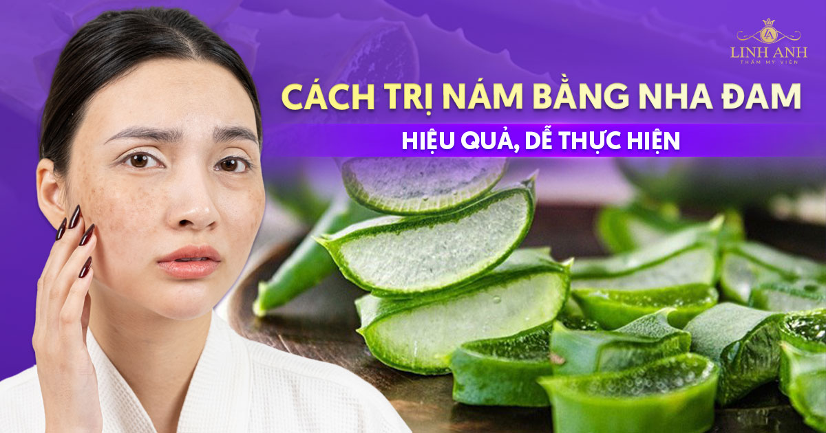 Bật mí 8 cách trị nám bằng nha đam hiệu quả, dễ thực hiện